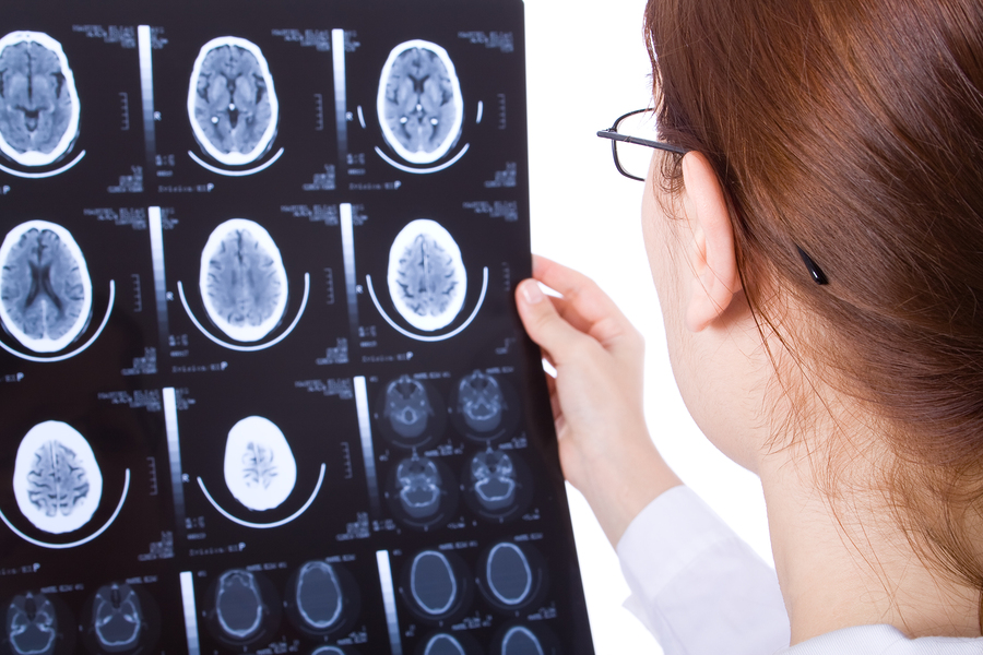 How Can a Brain Injury Attorney Advocate For You?